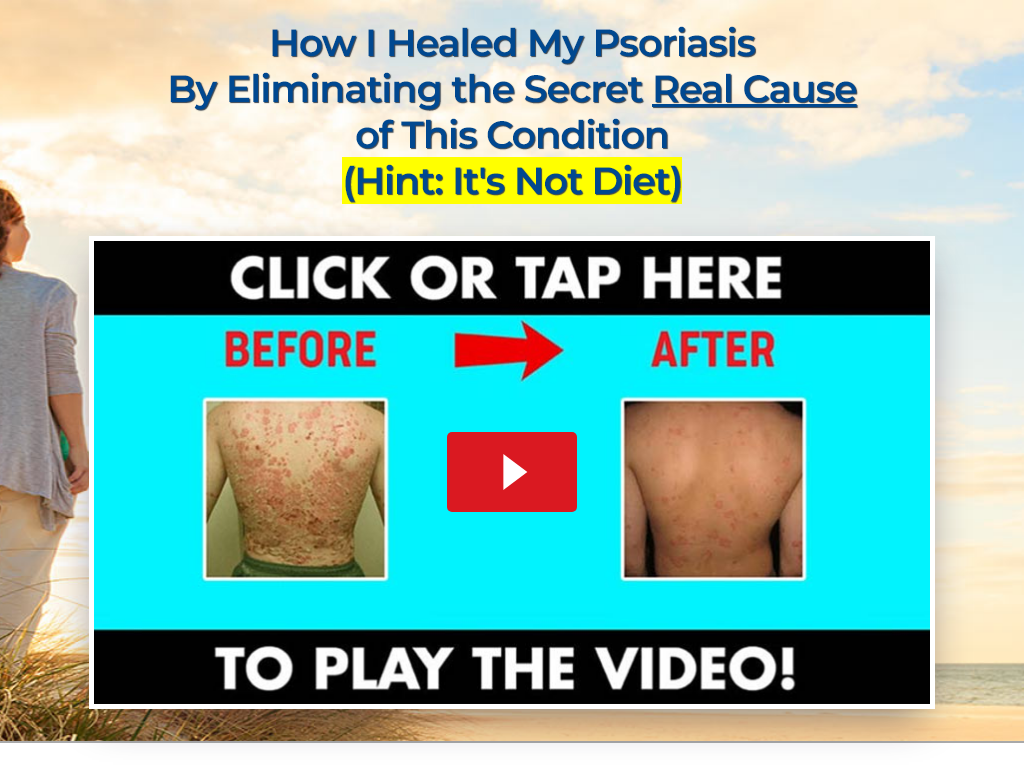 PSORIASIS REVOLUTION REVIEW : THE CHANGE VISIBLE AFTER 10 DAYS