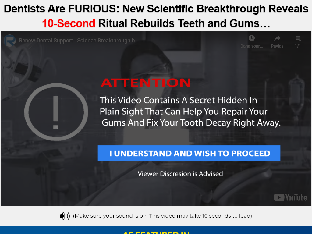 RENEW DENTAL SUPPORT REVIEW | HOW TO USE IT CORRECTLY