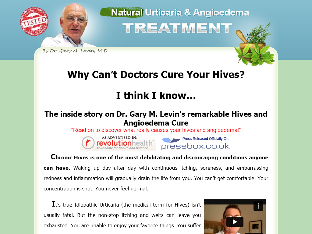URTICARIA & ANGIOEDEMA NATURAL TREATMENT SYTEM REVIEW | MY 48 HOUR WARNING TO NEW USERS